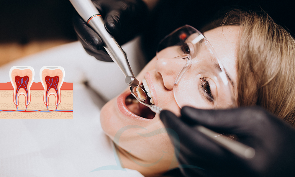 Dental Root Canal Treatment Prices in Turkey