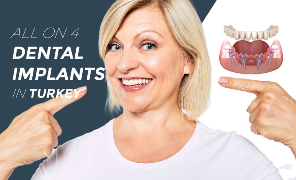 All on 4 Dental Implants in Turkey