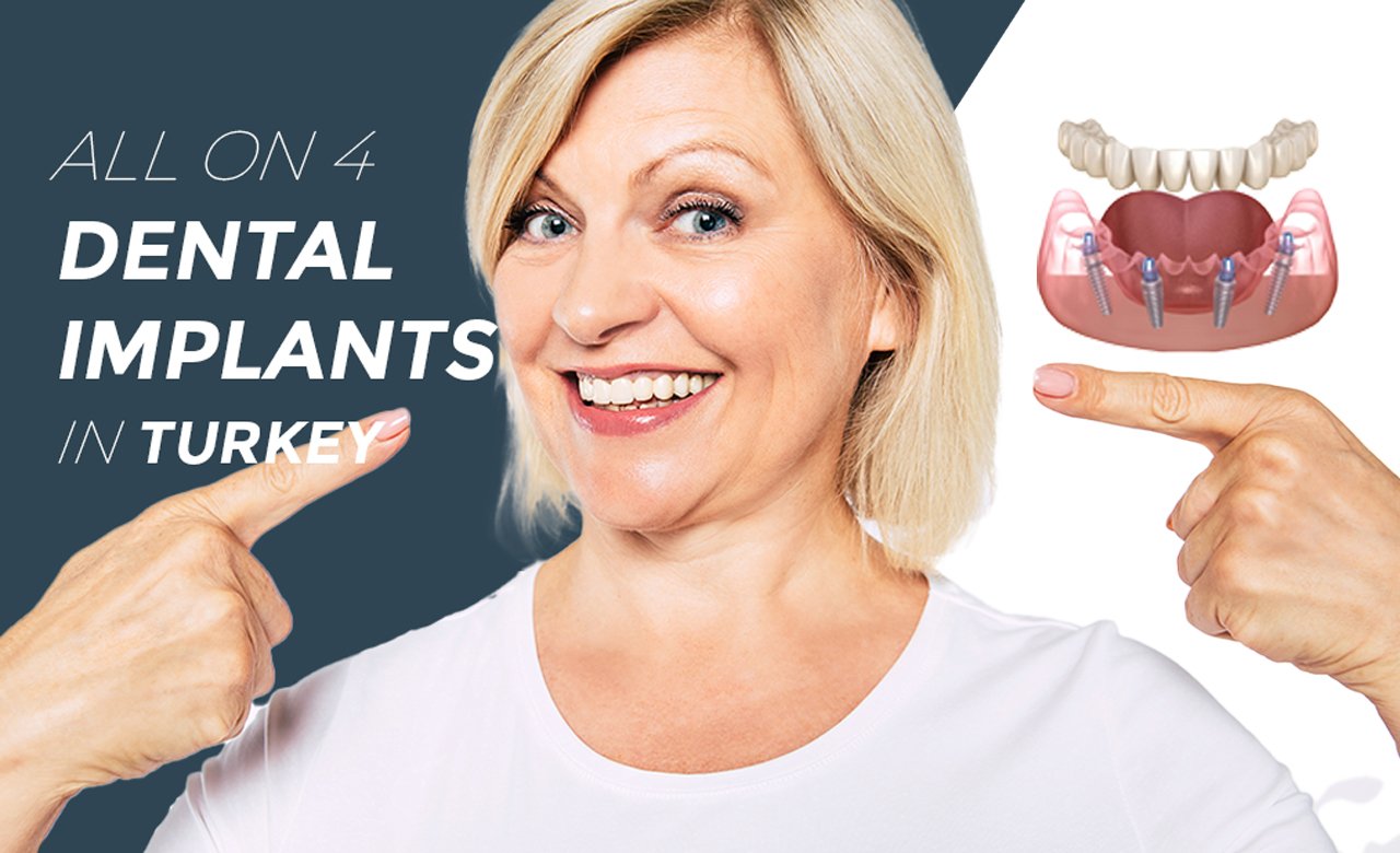 All on 4 Dental Implants in Turkey