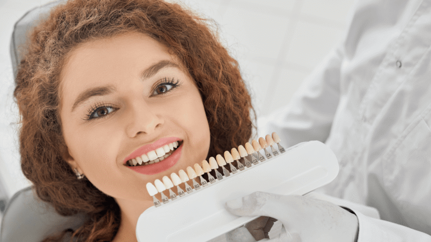 How many types of veneers are in Turkey?
