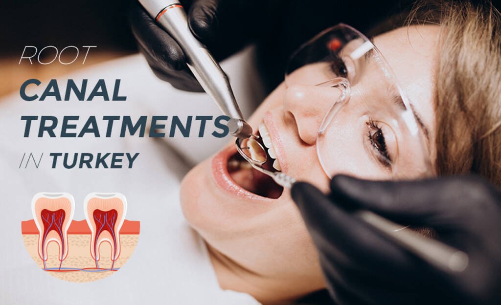 Root Canal Treatments in Turkey