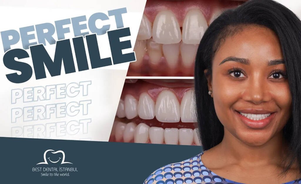 Smile Makeover in Turkey
