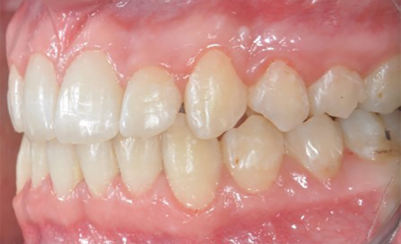 after-photos-orthodontic-treatments.jpg