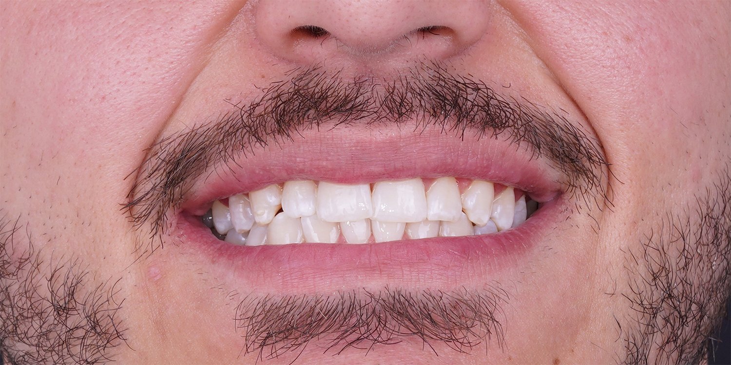 After