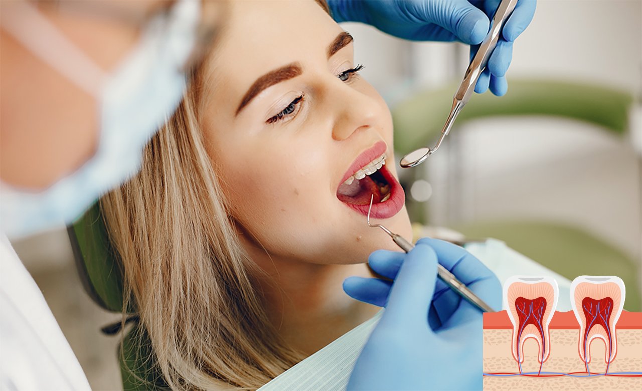 dental root canal treatment in turkey