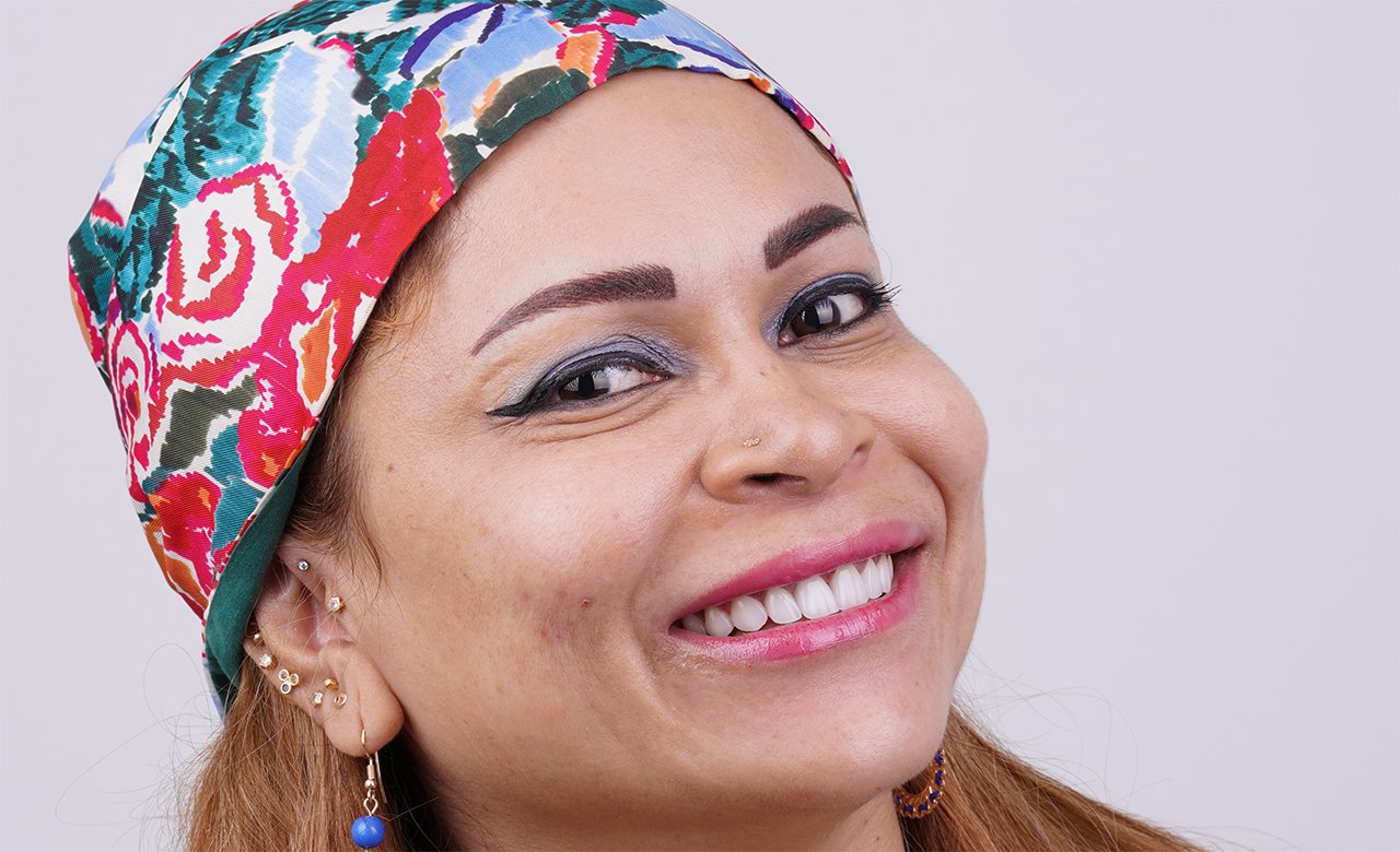 dental laminate veneers in turkiye
