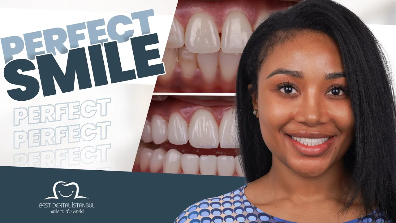 Smile Makeover in Turkey