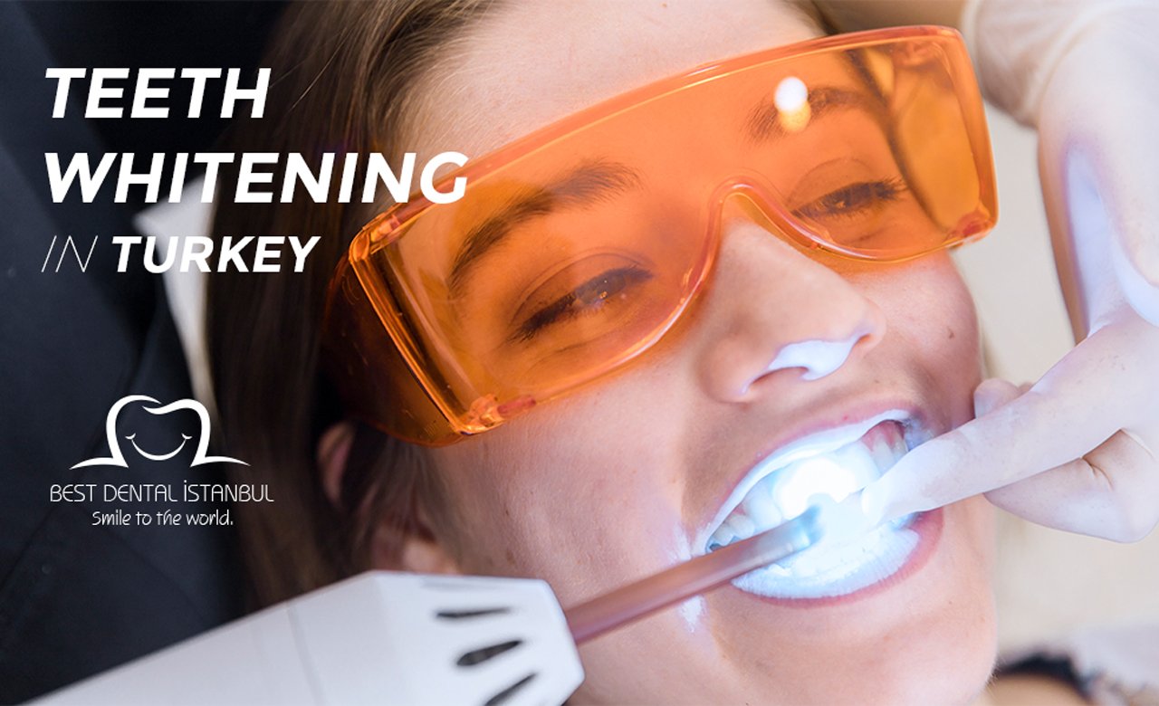 Teeth Whitening in Turkey