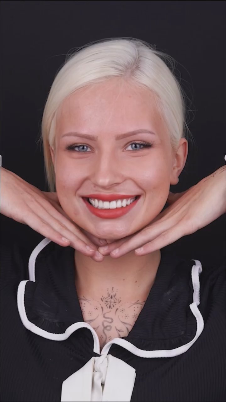 Poster image for a smile transformation with E.max veneers video