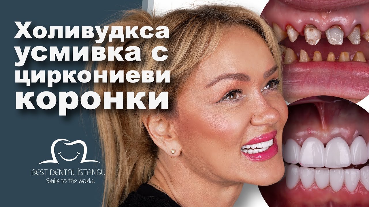 dental zirconium crowns treatments in turkey