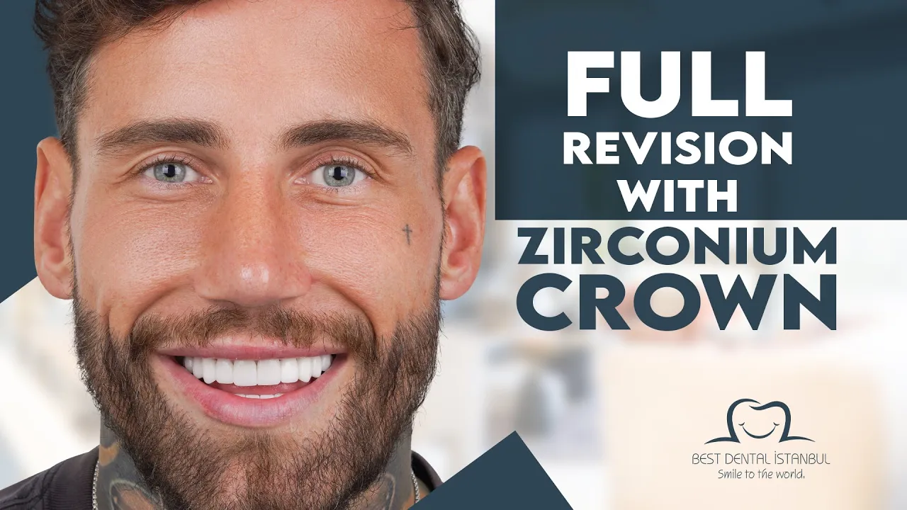 Full Set of Zirconium Crowns