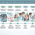 Getting Veneers in Istanbul: Procedure Steps, Costs, and Safety Tips