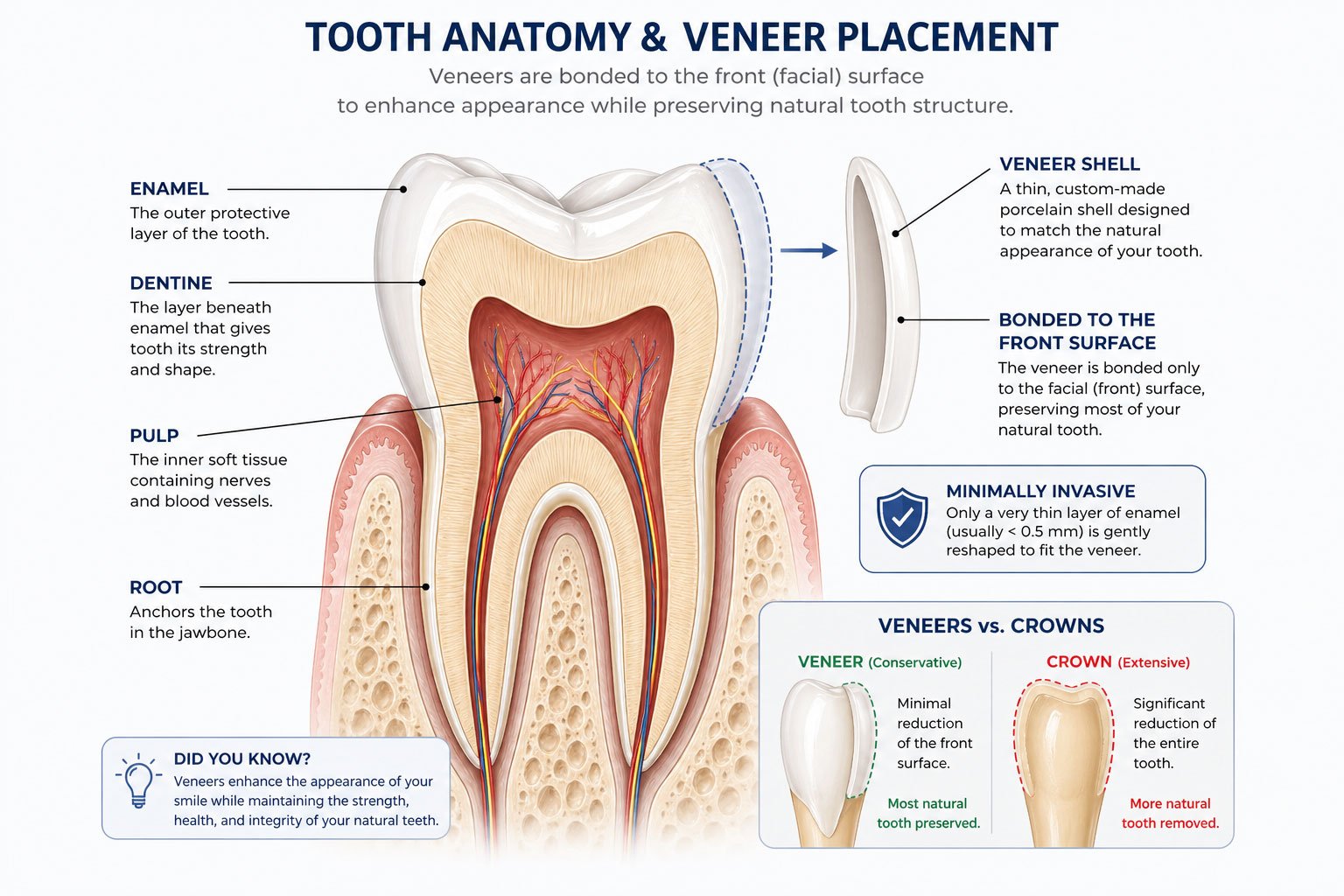 Tooth Anatomy & Veneer Placement